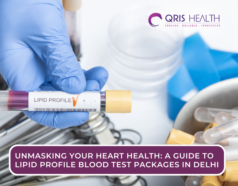 Lipid Profile Blood Test in Delhi